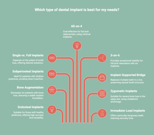 Infographic of the Most Common Types of Dental Implants