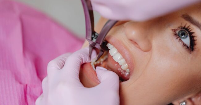 A woman undergoing a simple tooth extraction