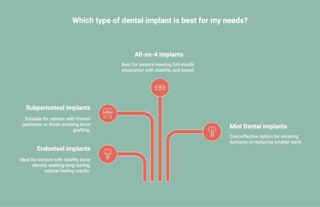 Infographic of What Are The Types of Dental Implants