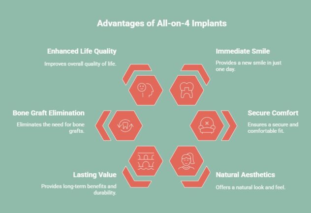 Infographic on advantages of all-on-4 implants