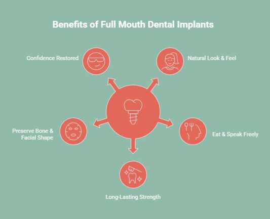 Infographic showing benefits of full mouth dental implants