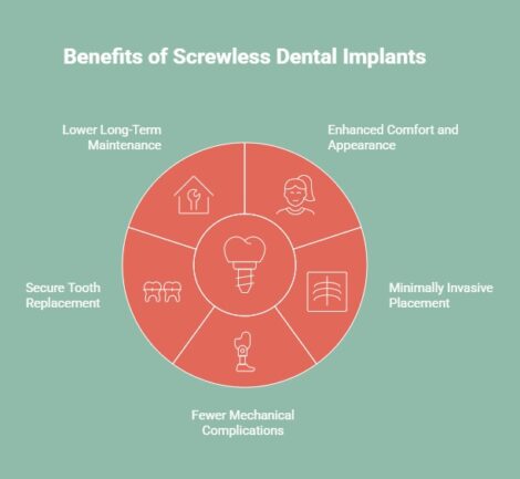 Infographic of Advantages of Screwless Dental Implants
