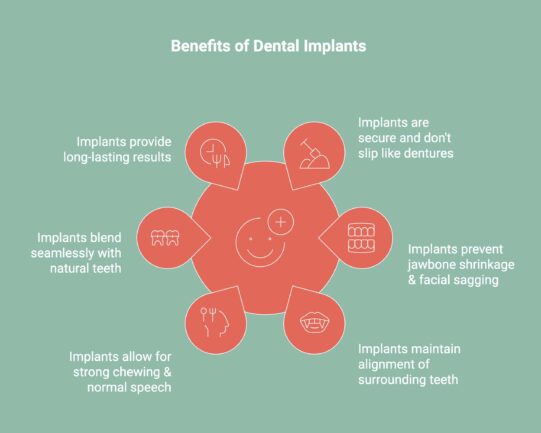 Infographic showcasing the benefits of Dental Implants