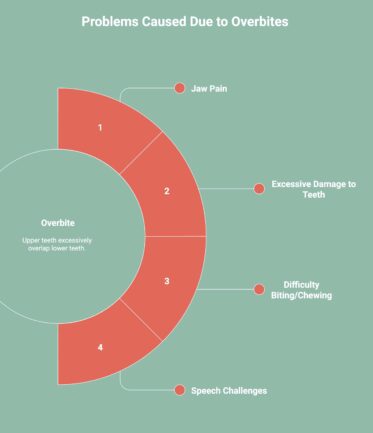 Infographic showcasing problems caused due to overbites