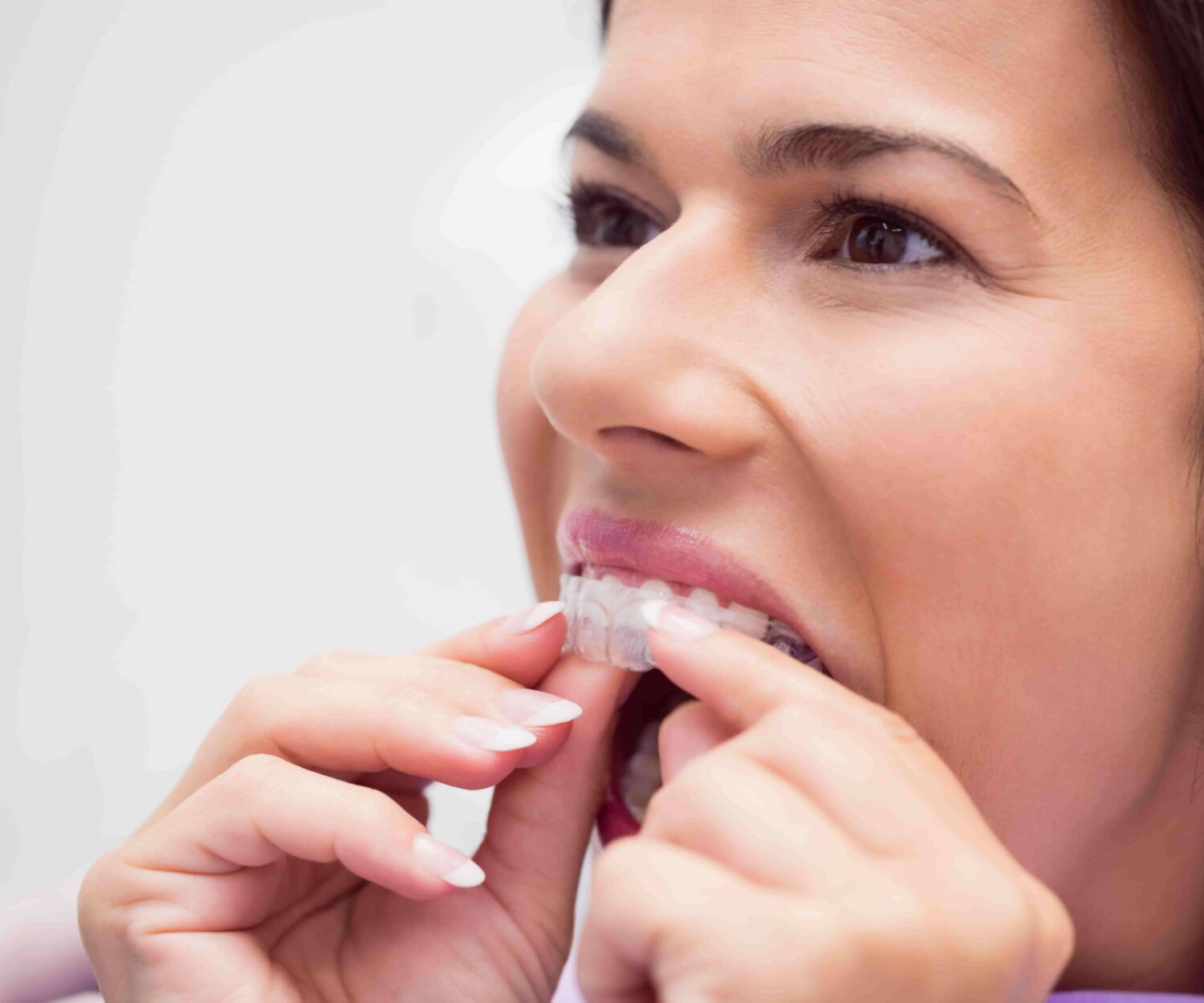 Patient putting on invisalign