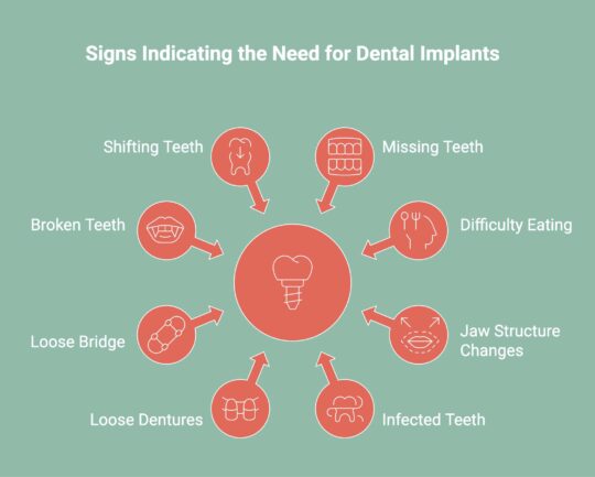 Infographic showcasing the signs indicating the need for dental implants