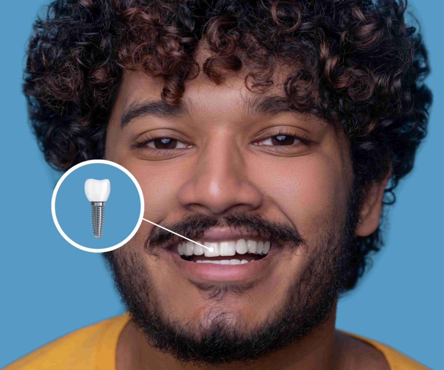 man with a dental implant