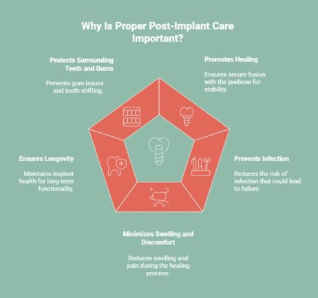 Infographic explaining the importance of proper post-implant care, with five key points: Protects surrounding teeth and gums, promotes healing, ensures longevity, prevents infection, and minimizes swelling and discomfort during the healing process.