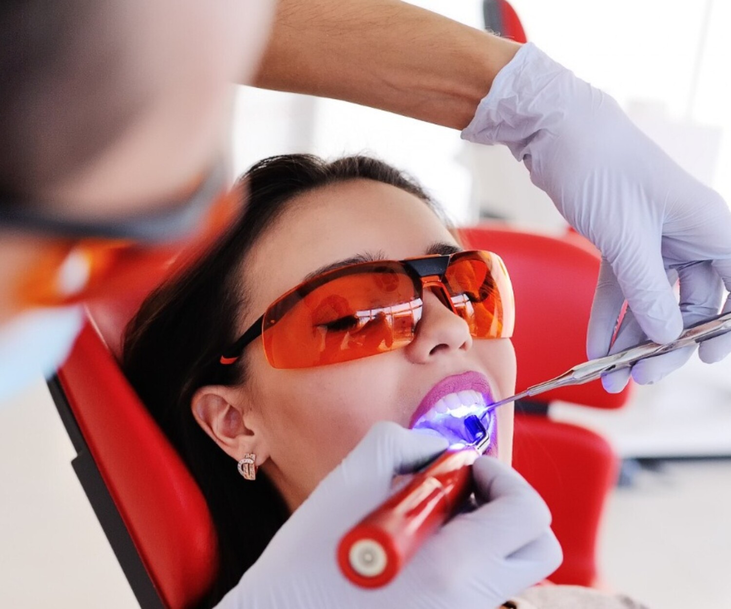 A dentist performing a teeth whitening treatment on a patient.