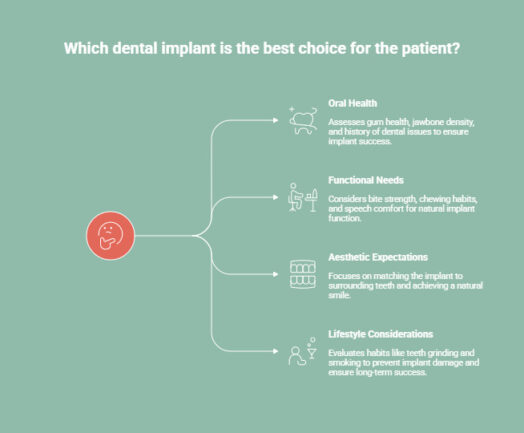 Infographic on What Makes a Dental Implant the “Best” Choice