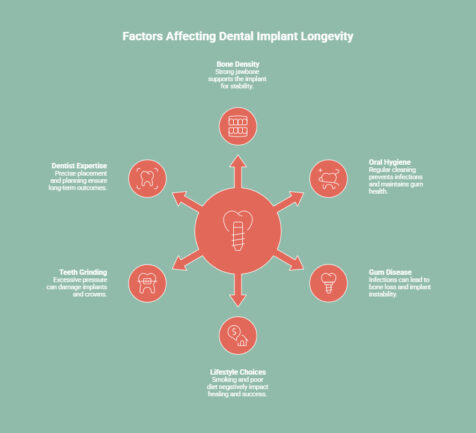 Infographic on What Factors Affect How Long Dental Implants Last