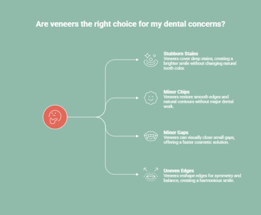 Infographic on When Are Veneers the Better Choice