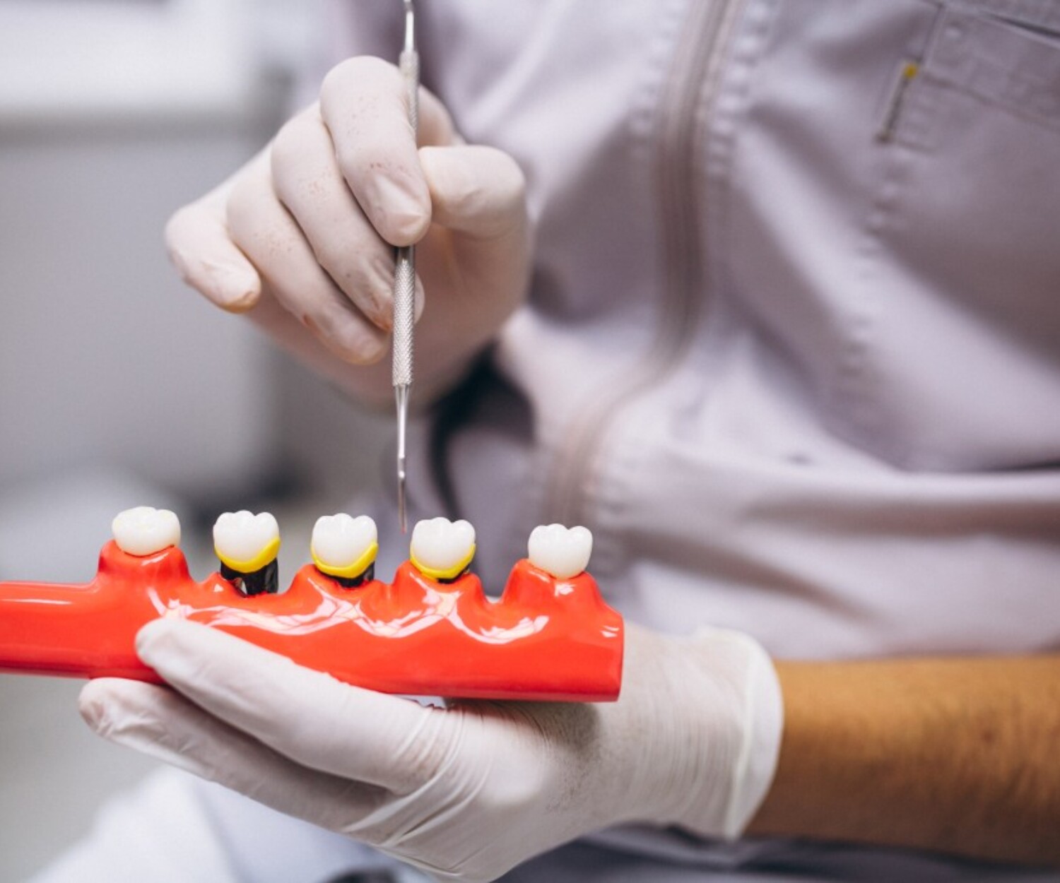 Dentist holding a dental bridge model and pointing to it with a dental tool.