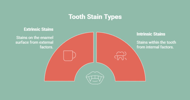 Types of Tooth Stains - visual selection