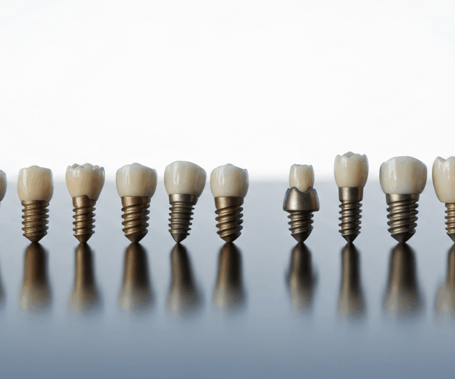 Different dental implants comparison