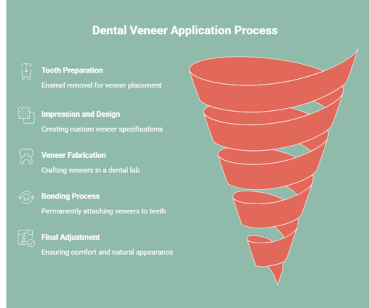 Dental Veneer Application Process Steps Explained