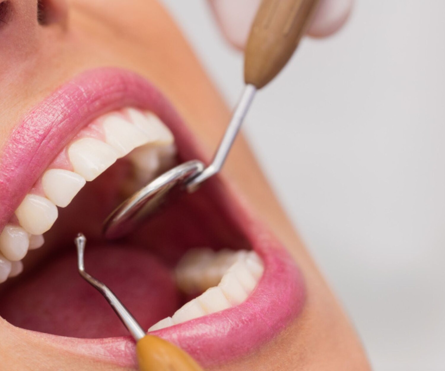 Dentist examining female patient teeth