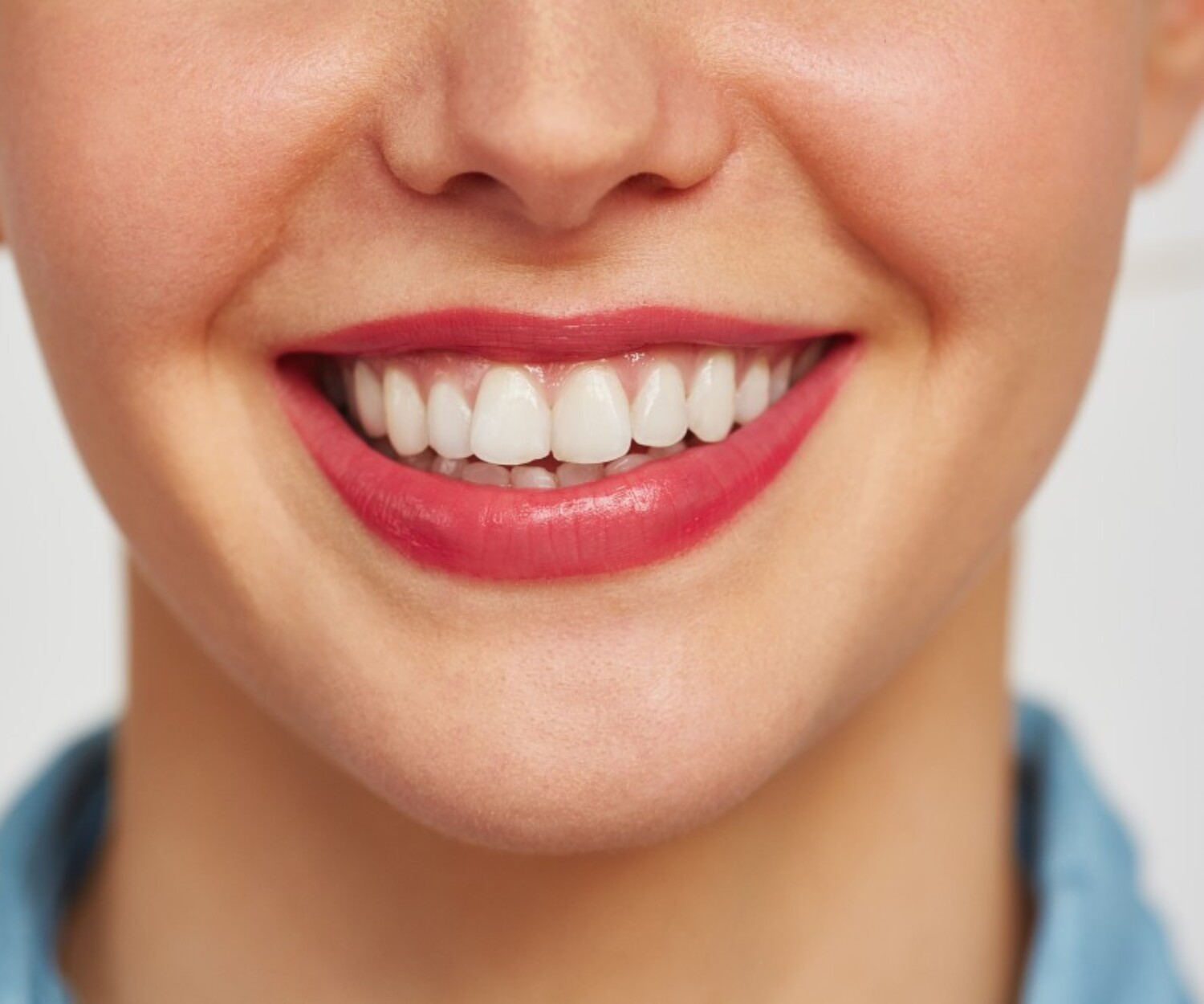 Bright natural smile showing smooth white dental veneers on front teeth