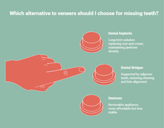 Infographic showing best alternatives to dental veneers for missing teeth, including dental implants, dental bridges, and dentures with brief descriptions of each option