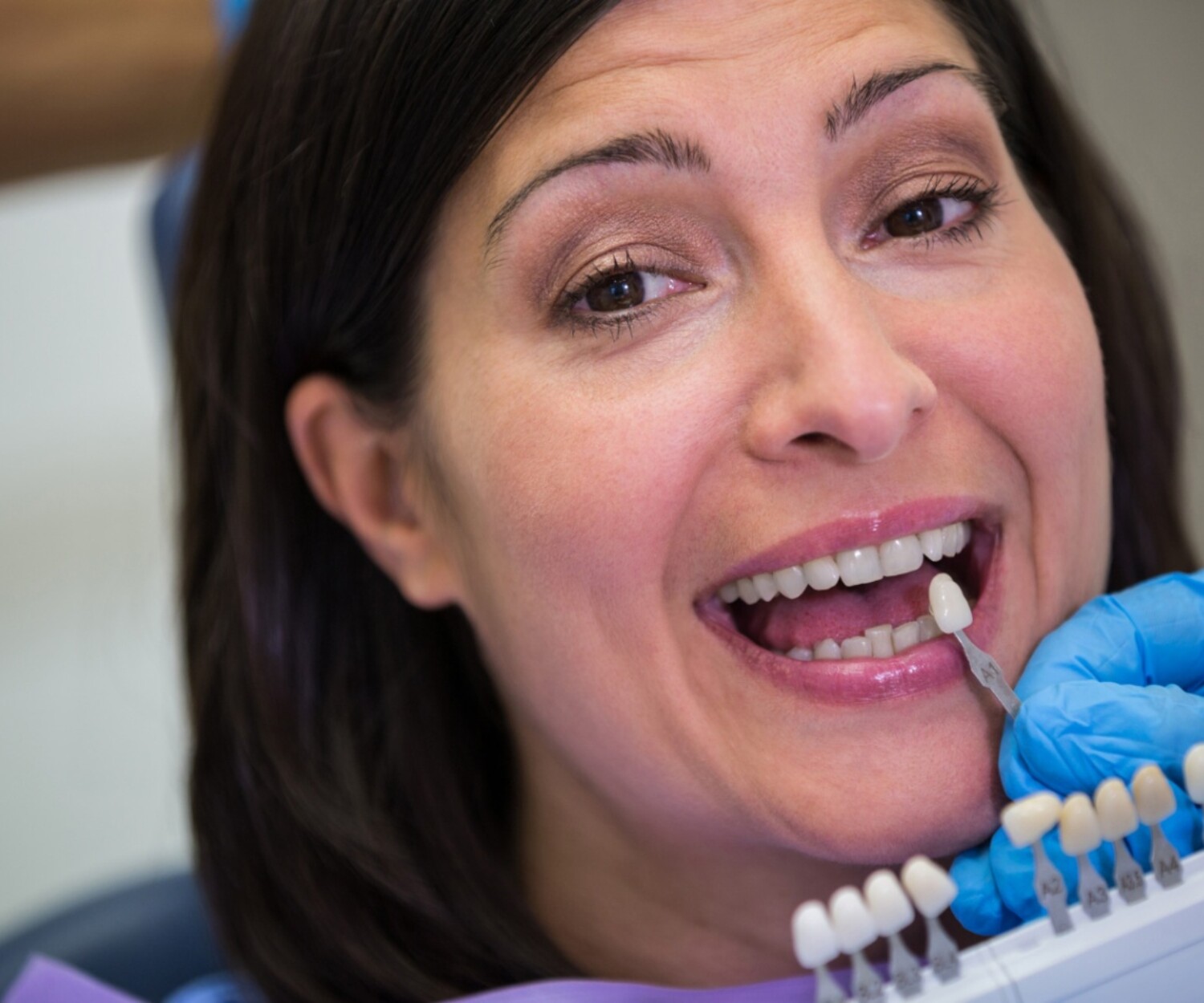 Dentist matching a dental veneer shade for a patient with a missing tooth during a cosmetic dentistry consultation