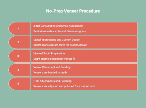 Infographics on No-Prep Veneer Procedure