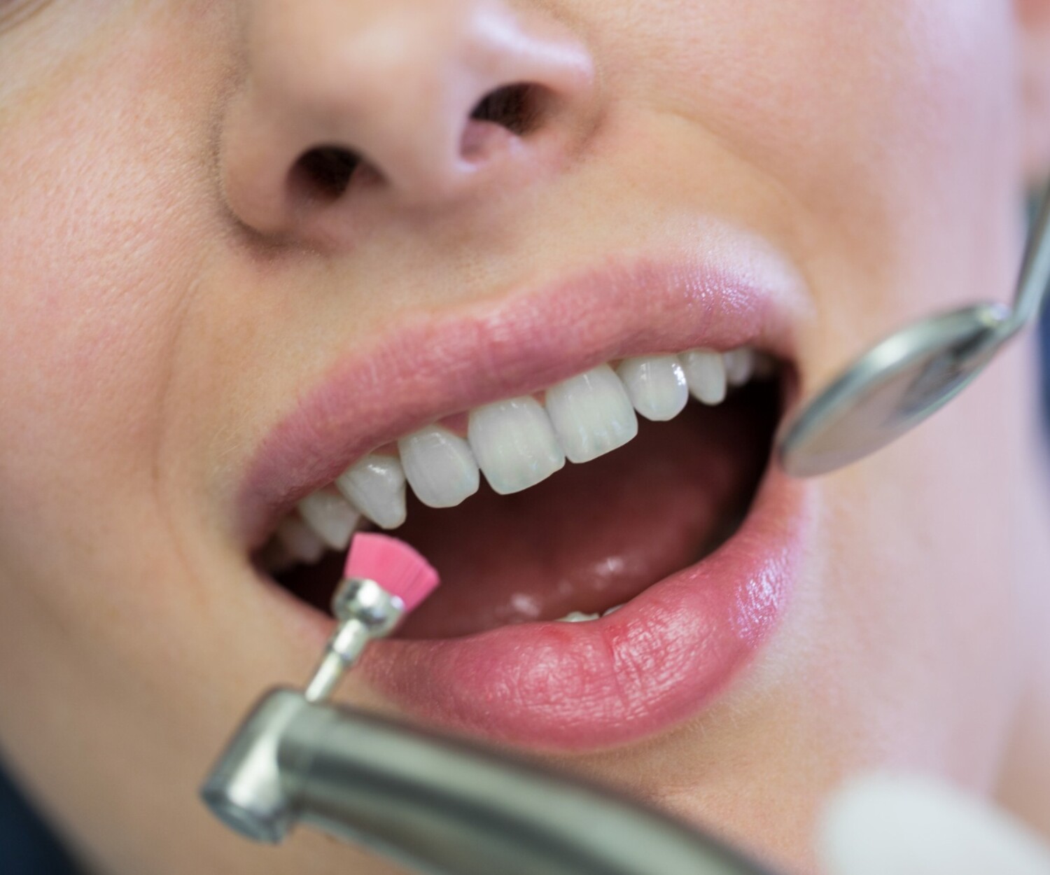 A close-up shot of a patient receiving a professional dental cleaning