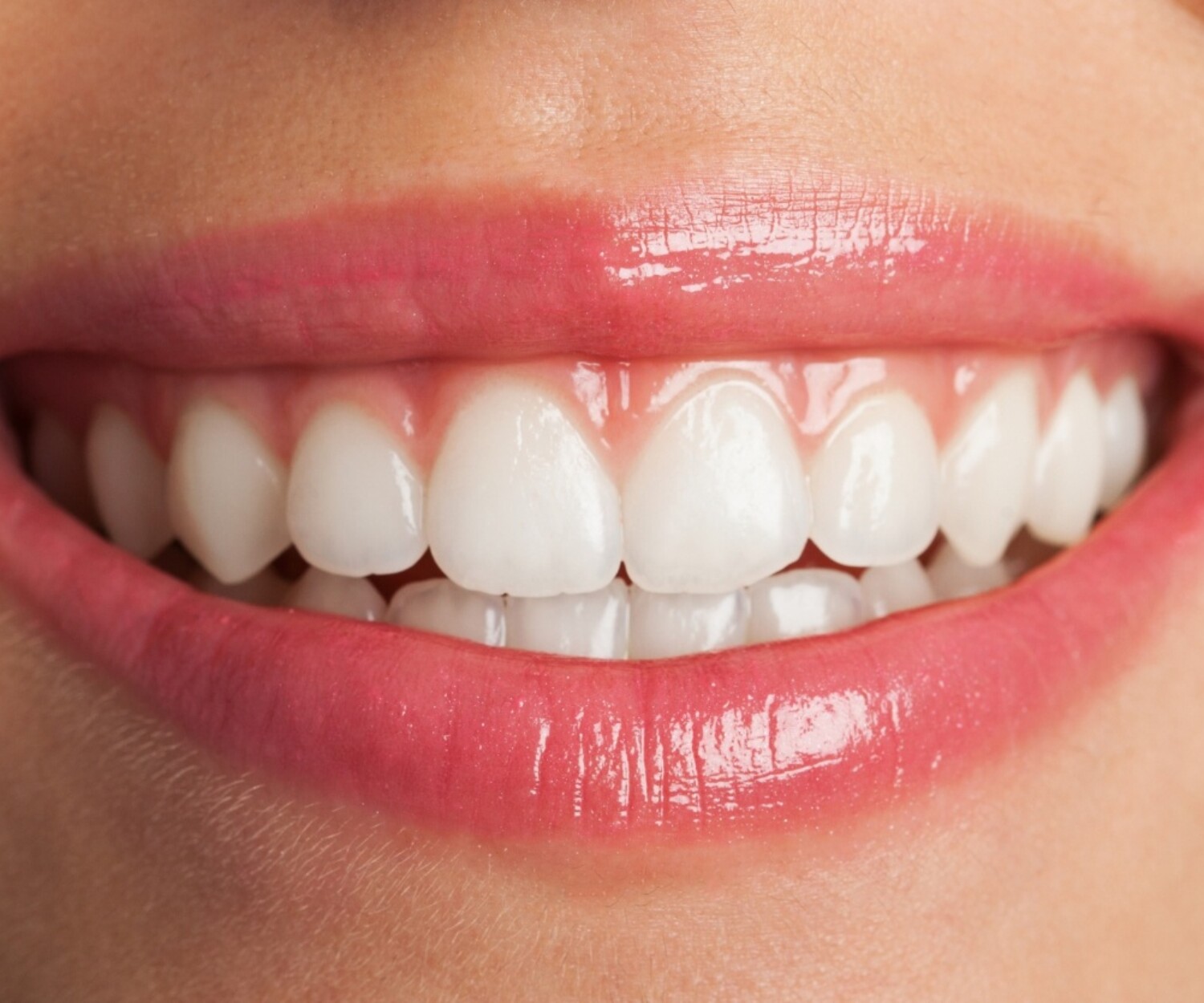 A close-up of a radiant, confident smile featuring perfectly aligned white teeth and soft pink lips, showcasing the results of excellent dental care