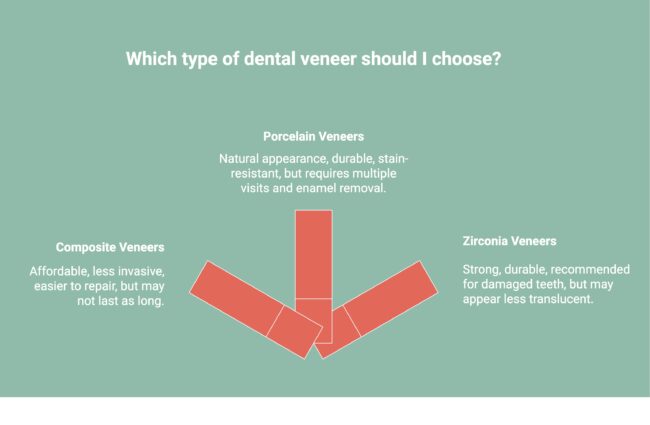 Infographic showcasing which type of dental veneer to choose