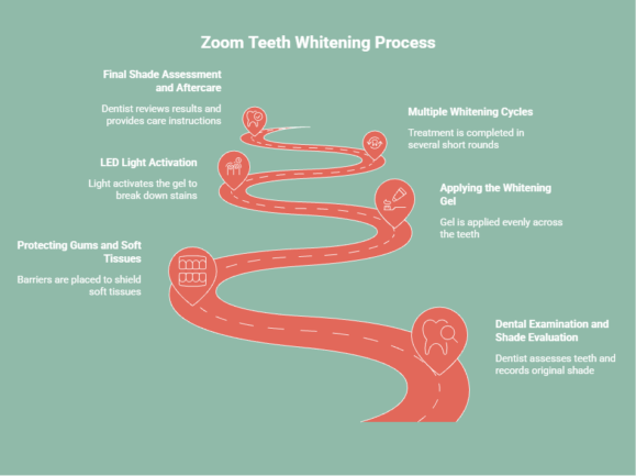 Zoom teeth whitening process infographic showing dental examination, whitening gel application, LED light activation, multiple whitening cycles, and aftercare steps