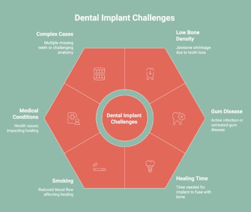 Infographic on Dental Implant Challenges