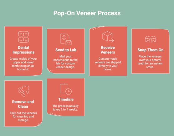 Infographic on Pop-On Veneer Process