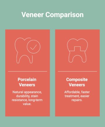 Infographic on Veneer Comparison